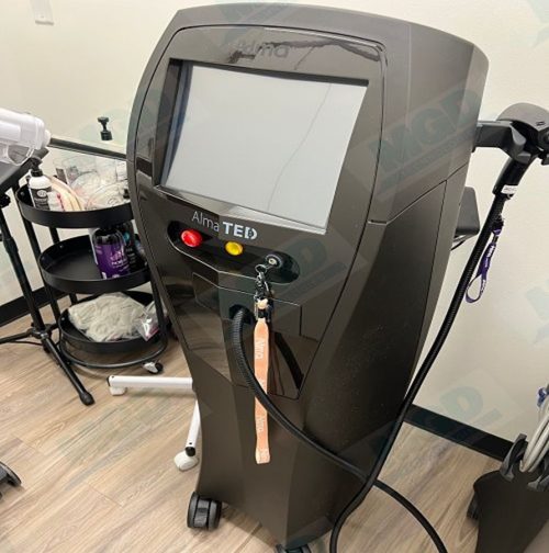 Alma Ted Hair Restoration