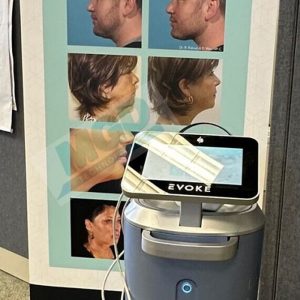 InMode Evoke RF Skin Tightening Machine