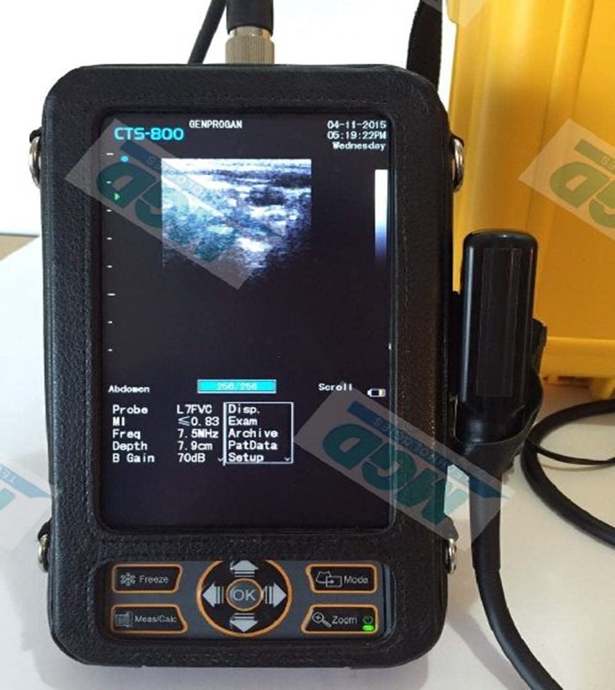 Siui CTS-800 Veterinary Ultrasound
