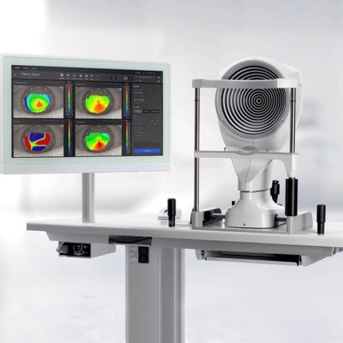 Zeiss Atlas 500 Corneal Topography