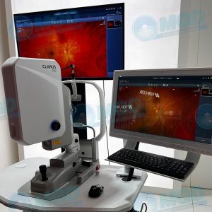 Zeiss Clarus 700 Ultra widefield Fundus Imaging