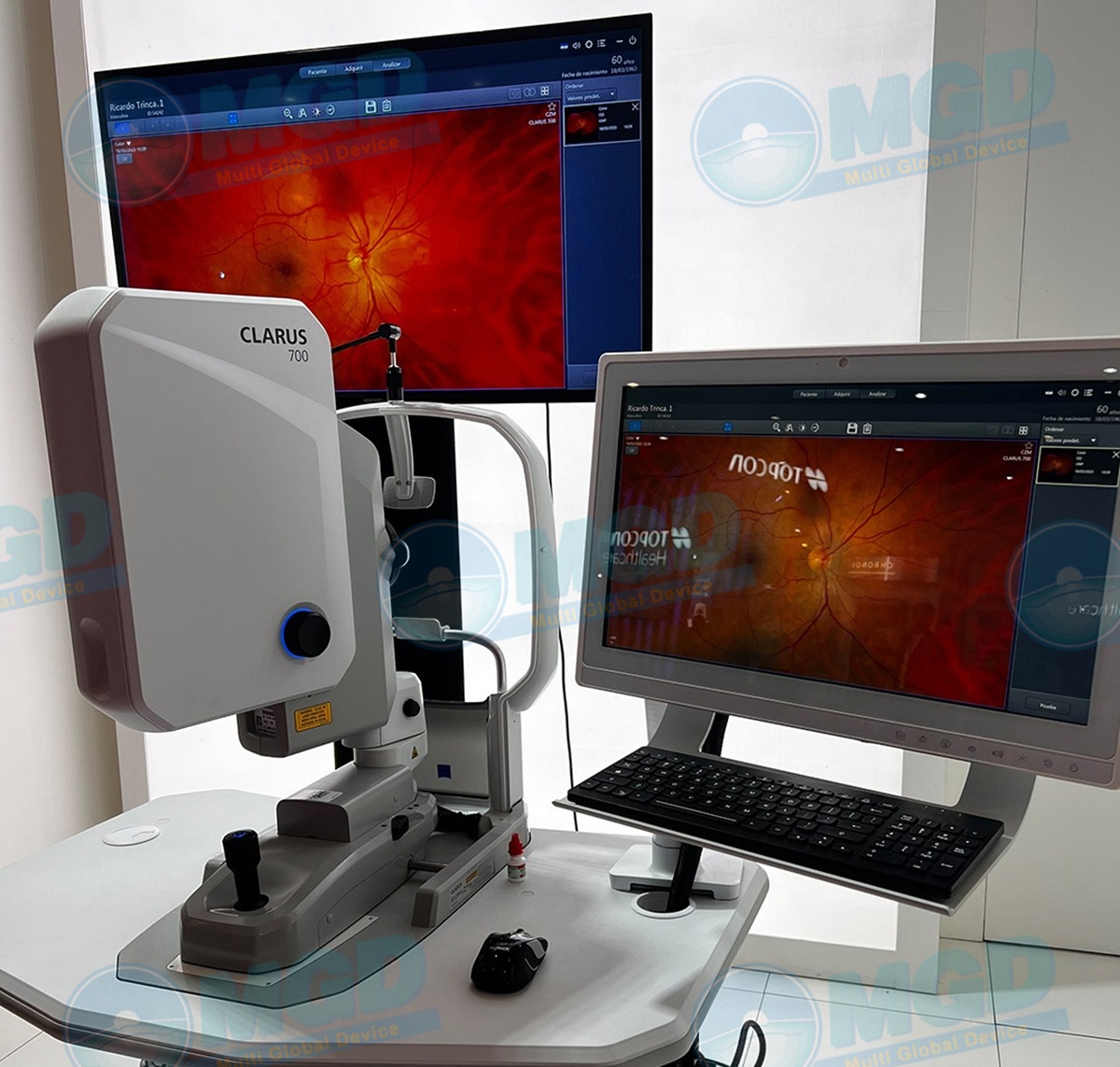 Zeiss Clarus 700 Ultra widefield Fundus Imaging
